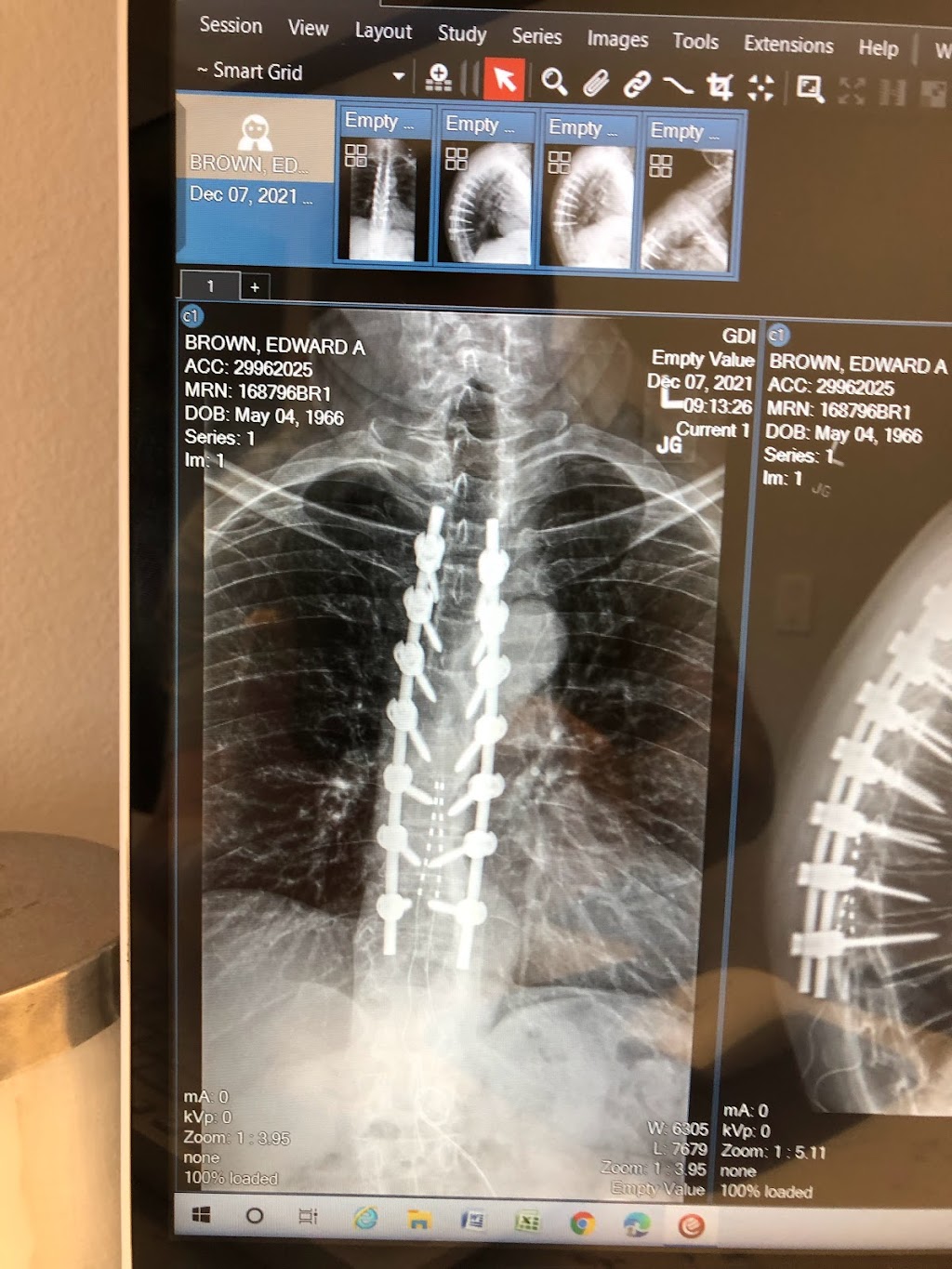 Grove Diagnostic Imaging, CT, MRI, Ultrasound, Nuc Med | 8263 Grove Ave #102, Rancho Cucamonga, CA 91730, USA | Phone: (909) 483-1296