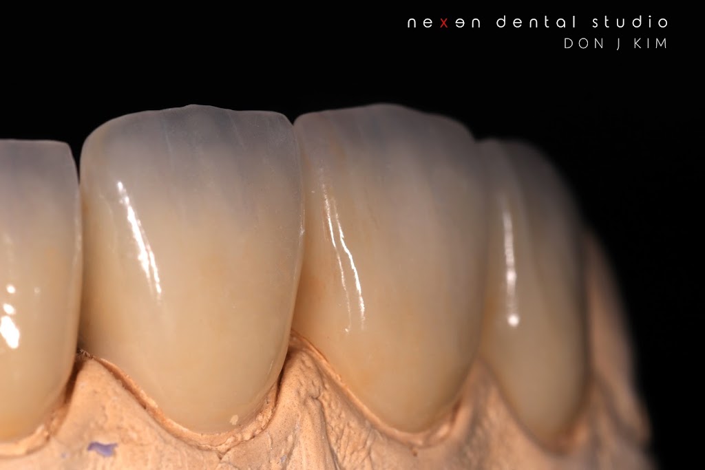 Nexen Dental Studio | 6552 Bolsa Ave. Ste #C, Huntington Beach, CA 92647, USA | Phone: (714) 622-5945