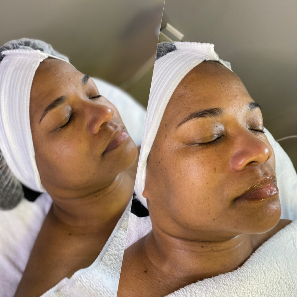 Regen The Skin | 2485 Old Washington Rd, Waldorf, MD 20601, USA | Phone: (240) 412-3096