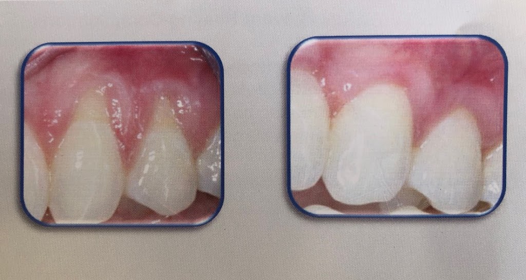 Nice Dental, Shiyu Wang, DDS, San Leandro | 299 Juana Ave # A, San Leandro, CA 94577, USA | Phone: (510) 969-7686