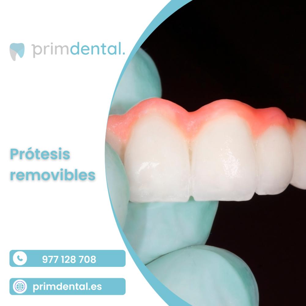 Primdental - Clínica Dental Reus | Raval de Martí Folguera, 22, 43201 baix, Tarragona, Spain | Phone: 0977 12 87 08