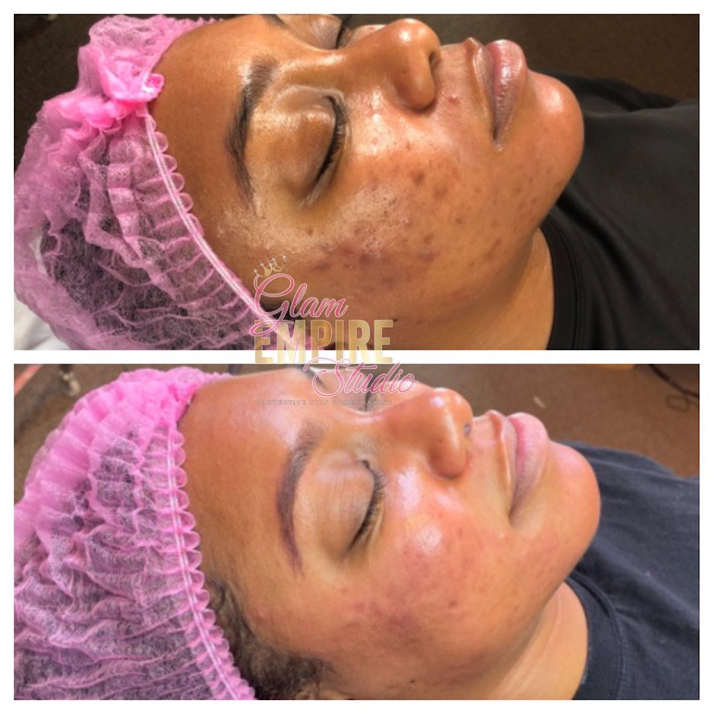 Glam Empire Studio LLC- Corrective Skin Care & Waxing | 213 Old Padonia Rd #2, Cockeysville, MD 21030, USA | Phone: (443) 826-0846