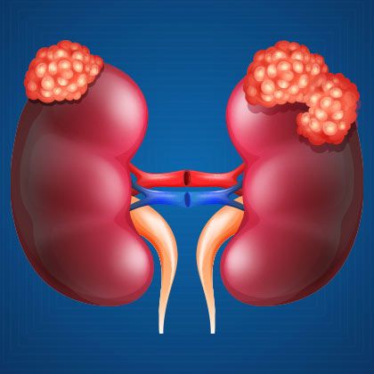 Urologist Tijuana | New City Medical Plaza, P.º del Centenario 9580 C 604, Zona Urbana Rio Tijuana, 22010 Tijuana, B.C., Mexico | Phone: (619) 392-8516