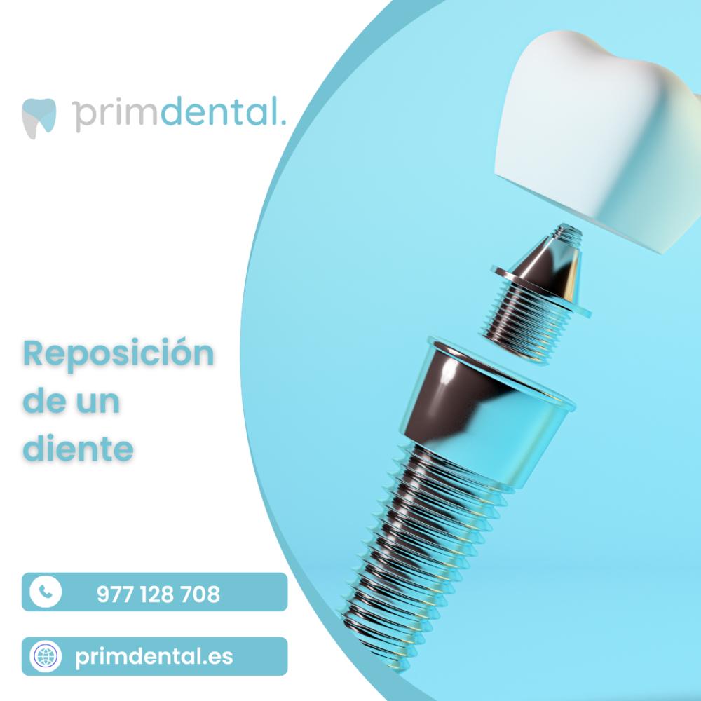 Primdental - Clínica Dental Reus | Raval de Martí Folguera, 22, 43201 baix, Tarragona, Spain | Phone: 0977 12 87 08