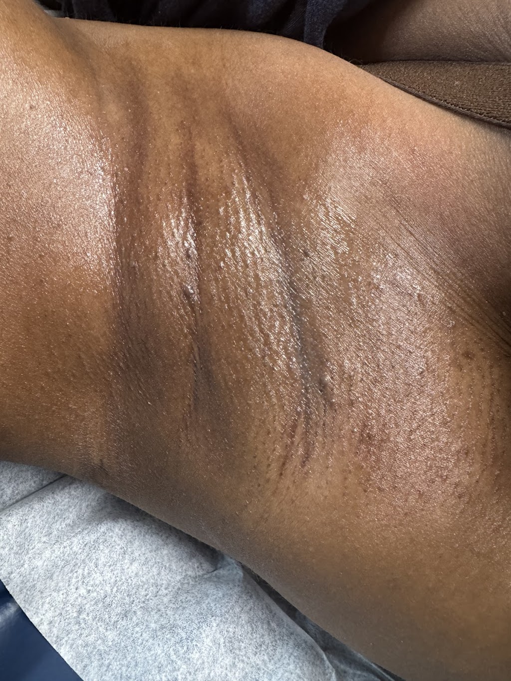 Snatching Bodies Beauti Bar-Hampton Brazilian Waxing | 3324 W Mercury Blvd Suite 6, Hampton, VA 23666, USA | Phone: (757) 532-5288