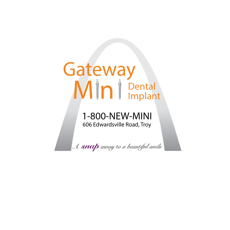 Gateway Mini Dental Implant Center | 606 Edwardsville Rd a, Troy, IL 62294, USA | Phone: (618) 667-8020