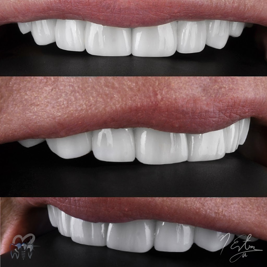 Paul Esteso DDS - Spectacular Smiles Dental | 11500 TX-121, Frisco, TX 75035, USA | Phone: (214) 407-8012