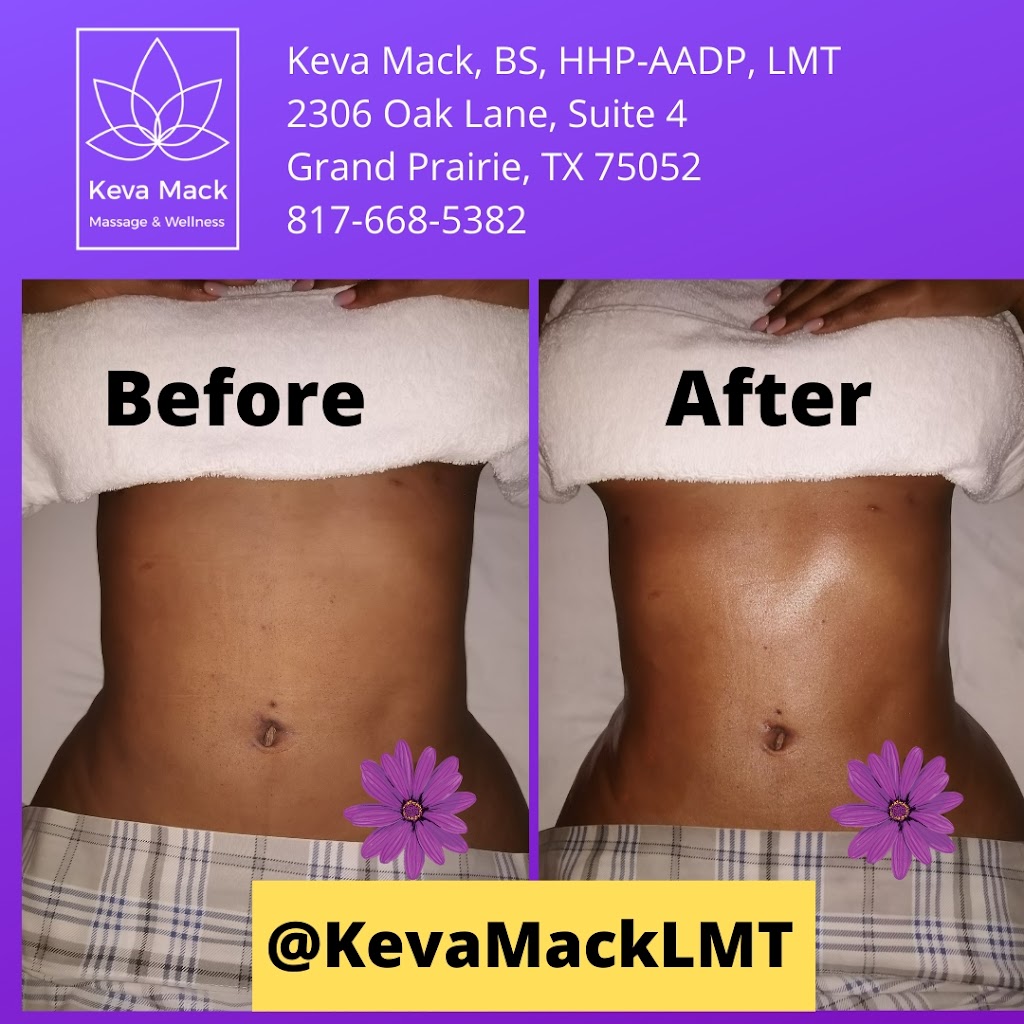 Keva Mack Massage & Wellness | 2306 Oak Ln Suite 4, Grand Prairie, TX 75051, USA | Phone: (817) 668-5382