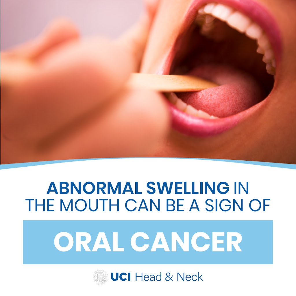 William Armstrong, MD | UCI Head & Neck | 250 E Yale Loop suite 200, Irvine, CA 92604, USA | Phone: (888) 826-2672