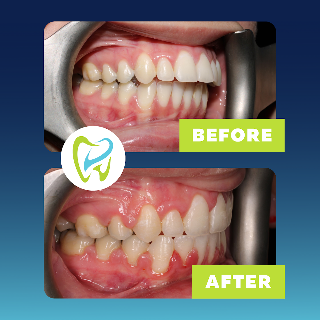 Orthodontics of Carson | 101 W Carson St Suite B, Carson, CA 90745, USA | Phone: (310) 626-0261