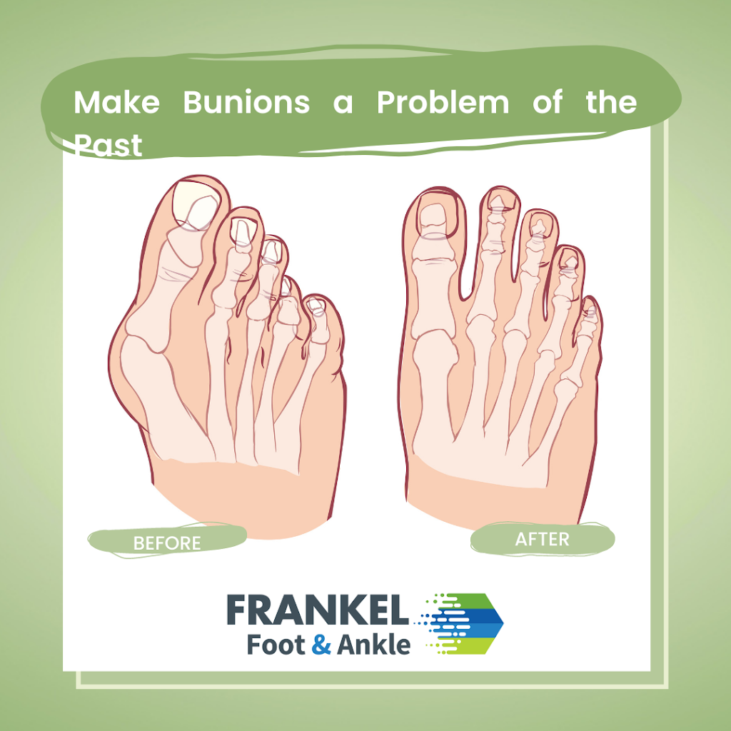 Frankel Foot & Ankle Center - Warwick Office | 2 Overlook Dr, Warwick, NY 10990, USA | Phone: (845) 343-6050