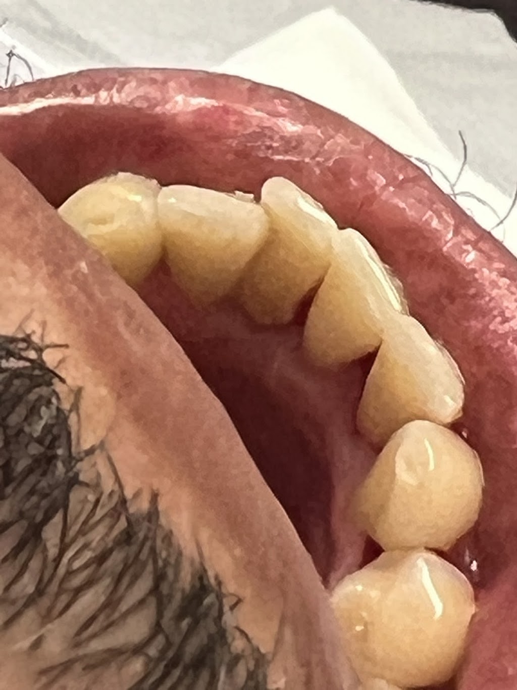 Today Dental of Golden Triangle | 5252 Golden Triangle Blvd STE 300, Fort Worth, TX 76244, USA | Phone: (817) 435-1200