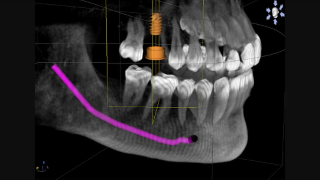 Concord Dental Group & Loveridge Dental Group | 4125 Concord Blvd a, Concord, CA 94519, USA | Phone: (925) 849-4469