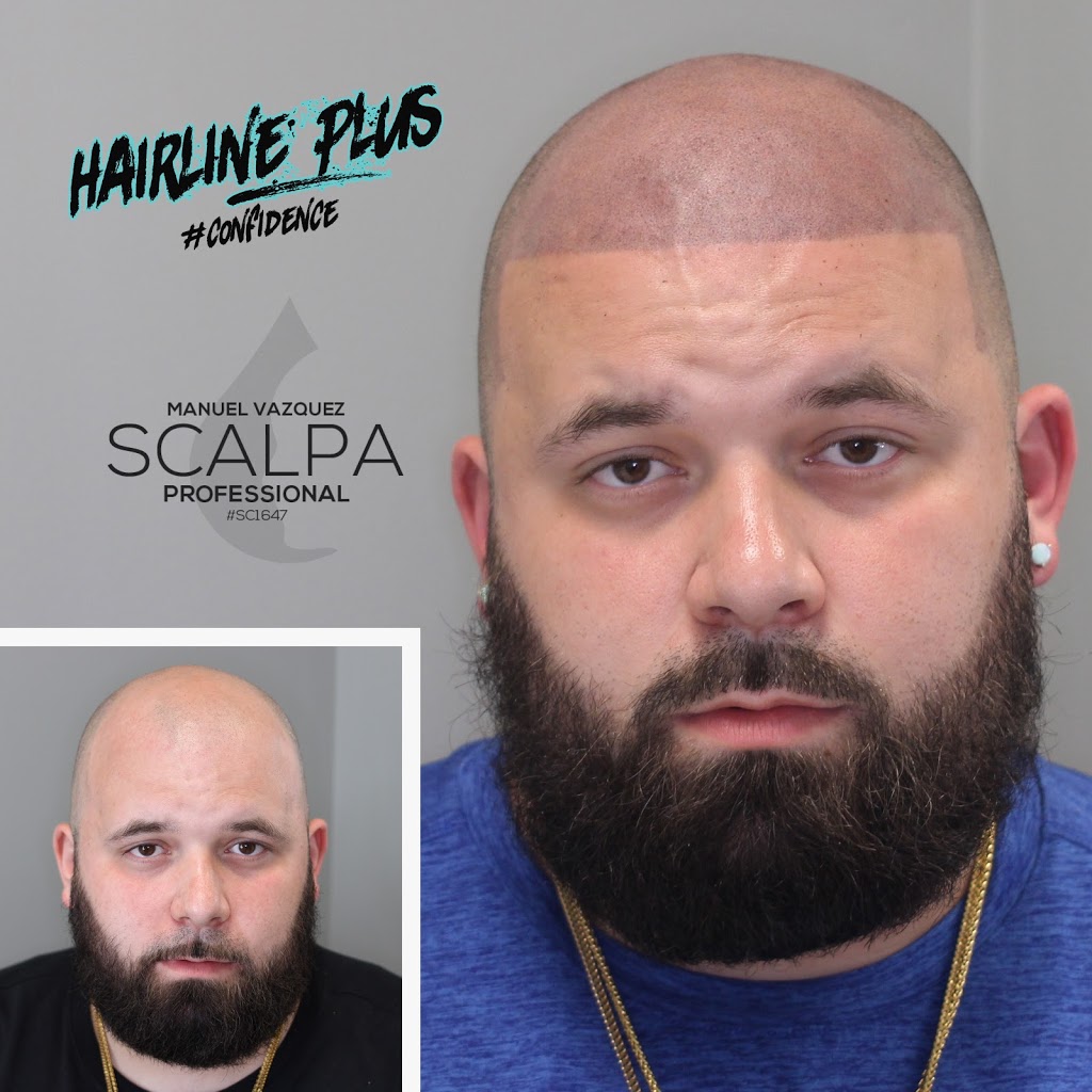 Hairline Plus | 1050 Stuyvesant Ave, Union, NJ 07083, USA | Phone: (908) 318-4018