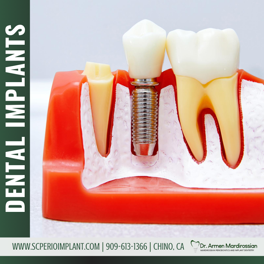 Mardirossian Periodontics and Implant Dentistry | 13197 Central Ave, Chino, CA 91710, USA | Phone: (909) 613-1366