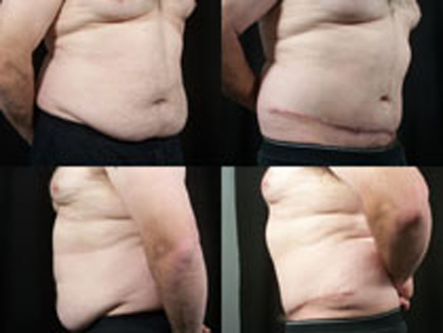 Glenn Herrmann MD | 130 Old Laramie Trail E, Lafayette, CO 80026, USA | Phone: (303) 664-9400