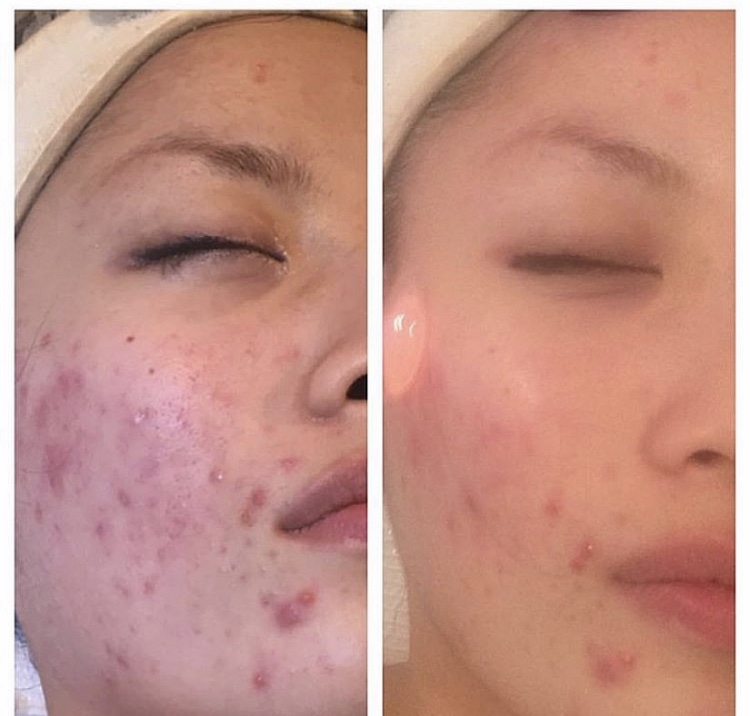 Skin Care by Anna | 12410 Burbank Blvd # 103, Valley Village, CA 91607, USA | Phone: (818) 414-7151