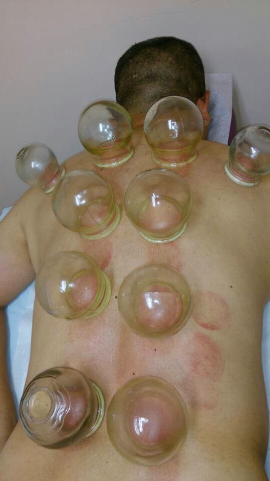 Reishi Acupuncture Clinic | 419 W Las Tunas Dr, San Gabriel, CA 91776, USA | Phone: (626) 382-6607 Reishi Acupuncture Clinic | 419 W Las Tunas Dr, San Gabriel, CA 91776, USA | Phone: (626) 382-6607