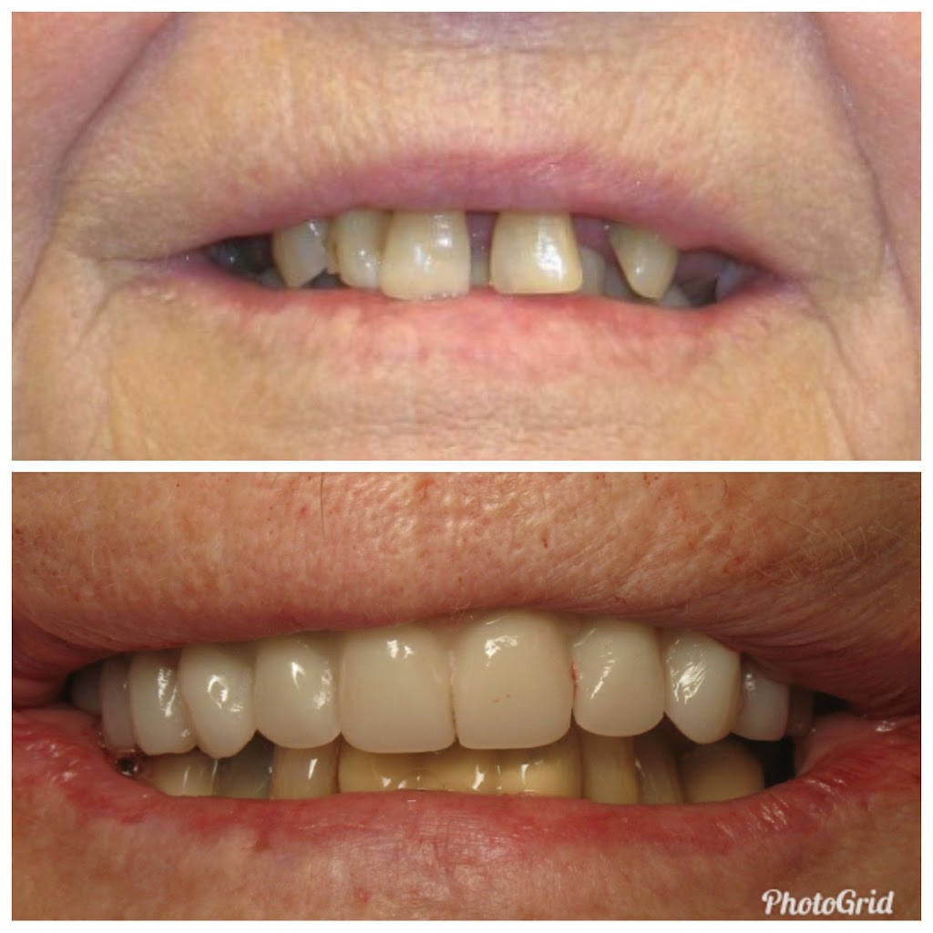 The Healthy Smile Dental Center: Dr. Jeffrey Gross DDS FAGD | 34586 Lakeshore Blvd, Eastlake, OH 44095, USA | Phone: (440) 951-7856