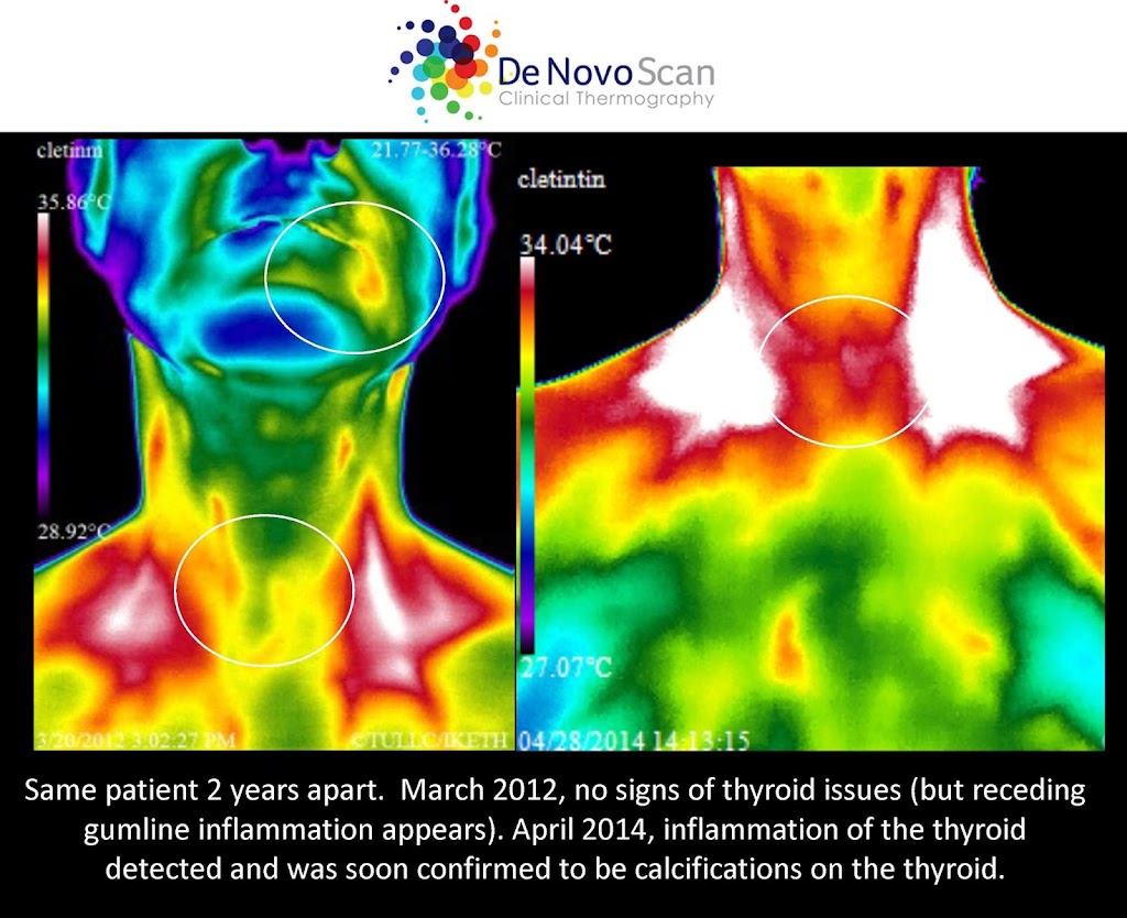 De Novo Scan, Clinical Thermography | 5949 E University Dr, Mesa, AZ 85205, USA | Phone: (480) 284-2222