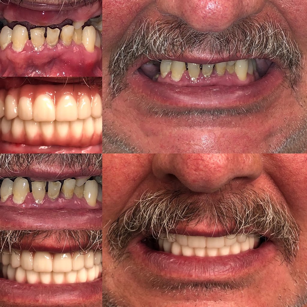 Teeth in a Day Florida | 7420 NW 5th St #109, Plantation, FL 33317, USA | Phone: (866) 341-6395