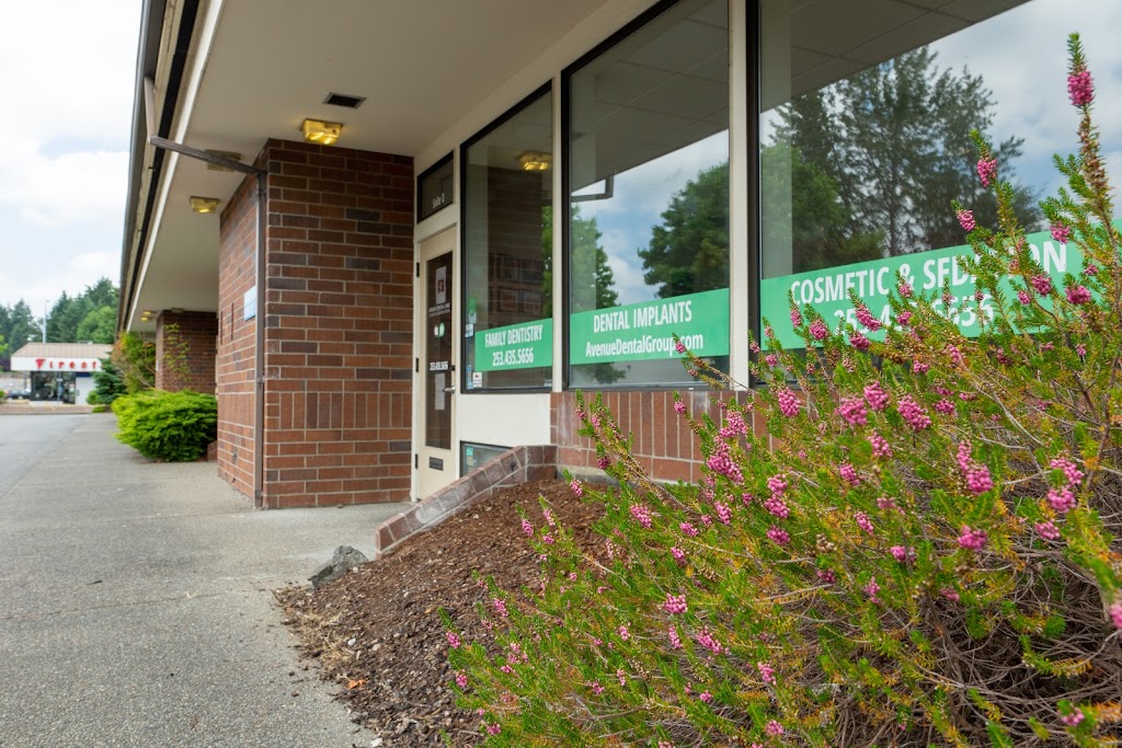 Avenue Dental Care | 903 40th Ave SW #200, Puyallup, WA 98374, USA | Phone: (253) 435-5656