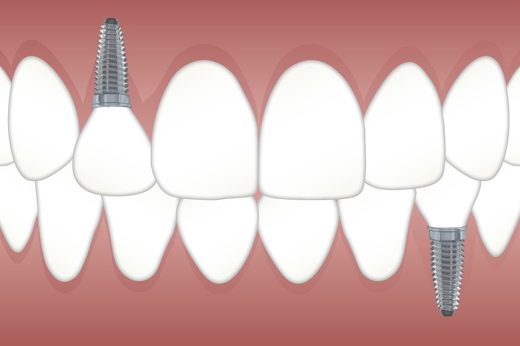 Trevisani Oral Surgery & Dental Implants | 929 US-441 STE 302, Lady Lake, FL 32159, USA | Phone: (352) 751-5100