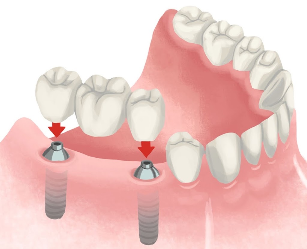 Smile Sarasota | 2389 Ringling Blvd Suite C, Sarasota, FL 34237, USA | Phone: (941) 957-3311