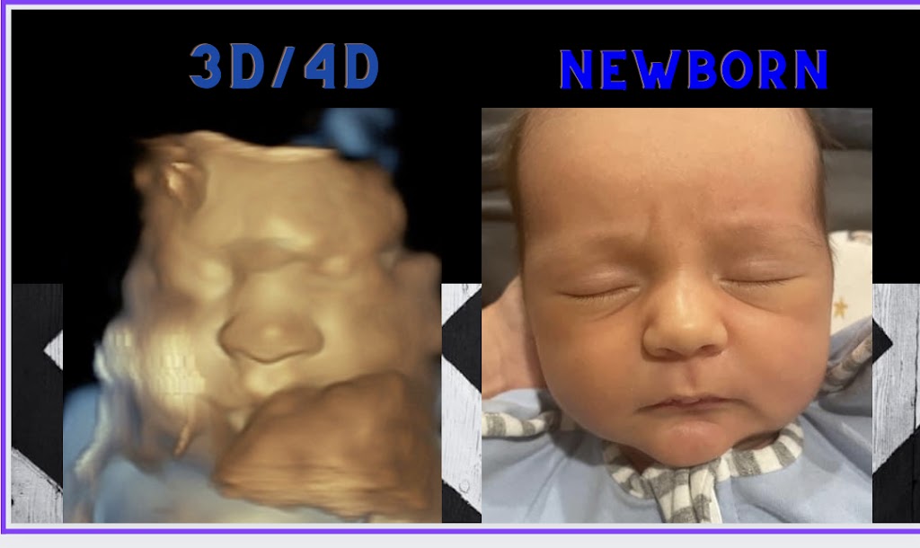 The Baby Studio 4D Ultrasound | 111 N 5th St, Chickasha, OK 73018, USA | Phone: (405) 759-4051