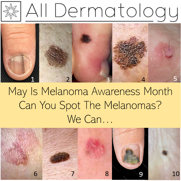 All Dermatology | 14239 W Bell Rd #101, Surprise, AZ 85374, USA | Phone: (623) 544-7755