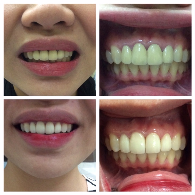 All Smiles Dentistry - Dr. Sheyda Zahiri | 4130 N 108th Ave suite101, Phoenix, AZ 85037 | Phone: (623) 535-9164