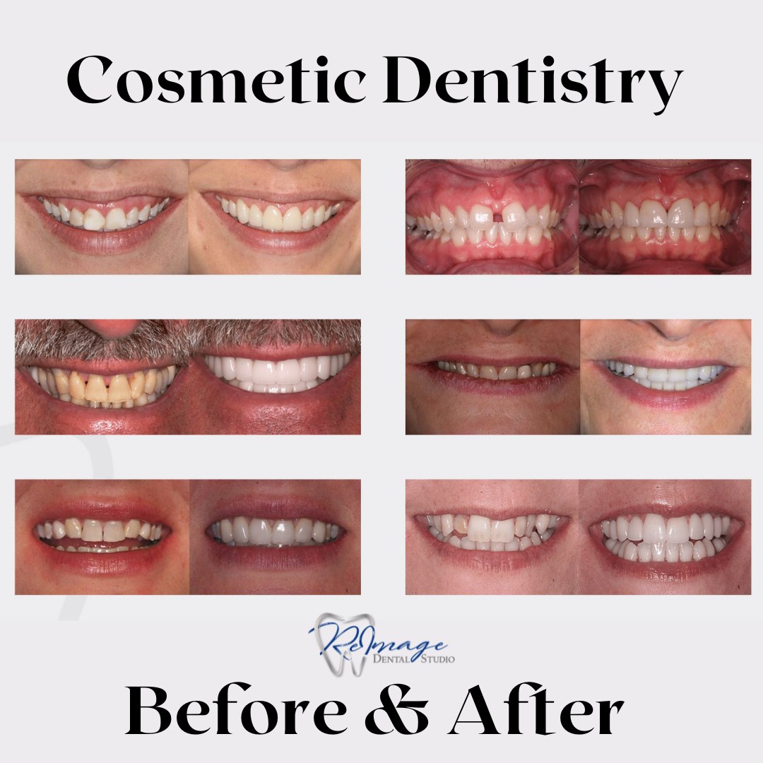 Reimage Dental Studio | 8147 E Evans Rd #1, Scottsdale, AZ 85260, United States | Phone: (480) 443-3552