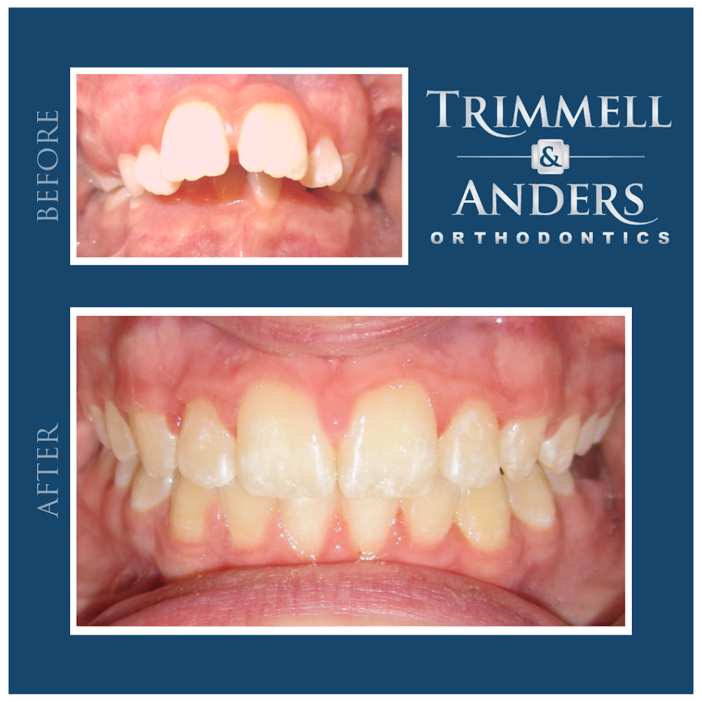 Trimmell Anders & White Orthodontics | 2143 N, Collective Ln, Wichita, KS 67206, USA | Phone: (316) 260-6566