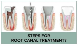 Osseo Family Dental | 30 Central Ave, Osseo, MN 55369, United States | Phone: (763) 425-2626