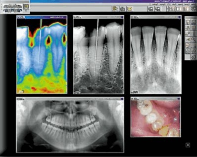 Extra Mile Dentist | 1115 Upper Hembree Rd UNIT C, Roswell, GA 30076, USA | Phone: (678) 674-6466