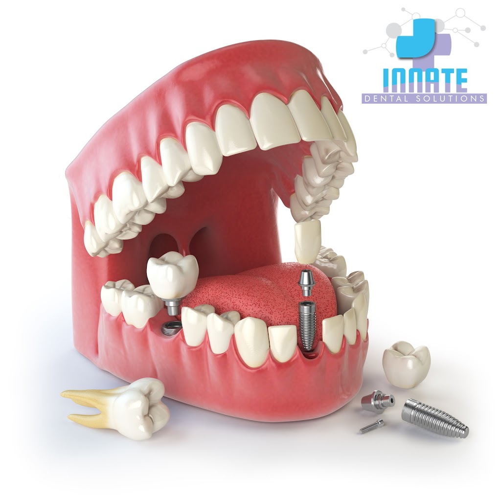 Innate Dental Solutions | 4708 W Plano Pkwy STE 200, Plano, TX 75093 | Phone: (972) 519-0990