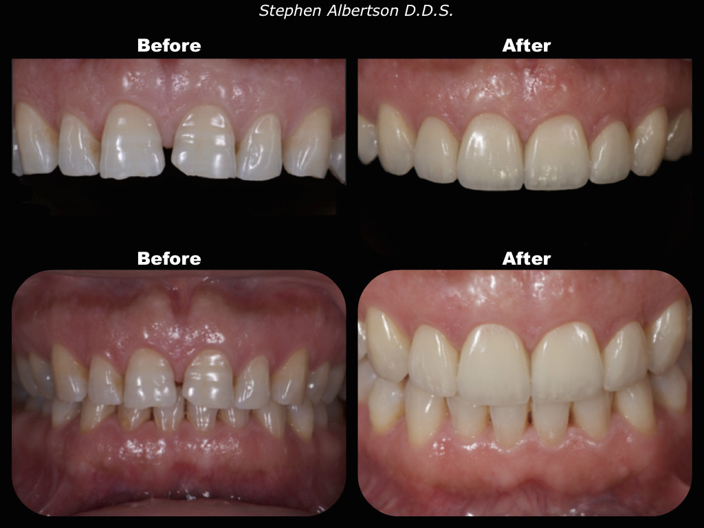 Stephen C. Albertson, DDS | 1751 Foothill Blvd, La Cañada Flintridge, CA 91011, USA | Phone: (818) 952-8991