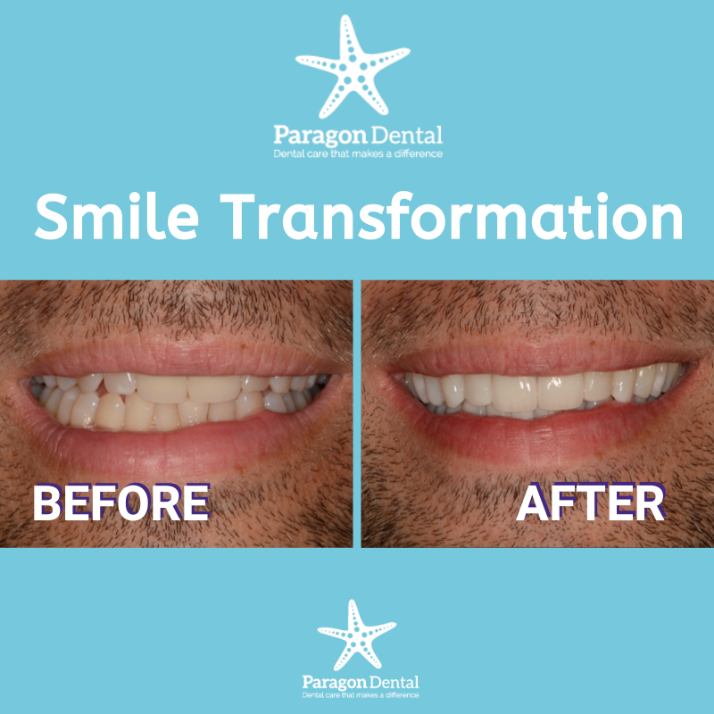 Paragon Dental | 1221 Golden Gate Dr, Papillion, NE 68046, USA | Phone: (402) 331-2070