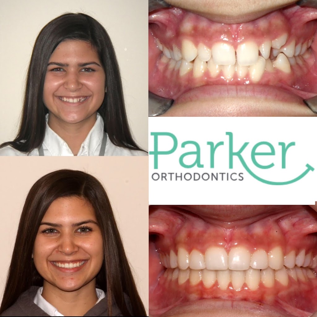 Parker Orthodontics | 200 Railroad Ave, Donaldsonville, LA 70346, USA | Phone: (225) 473-6434