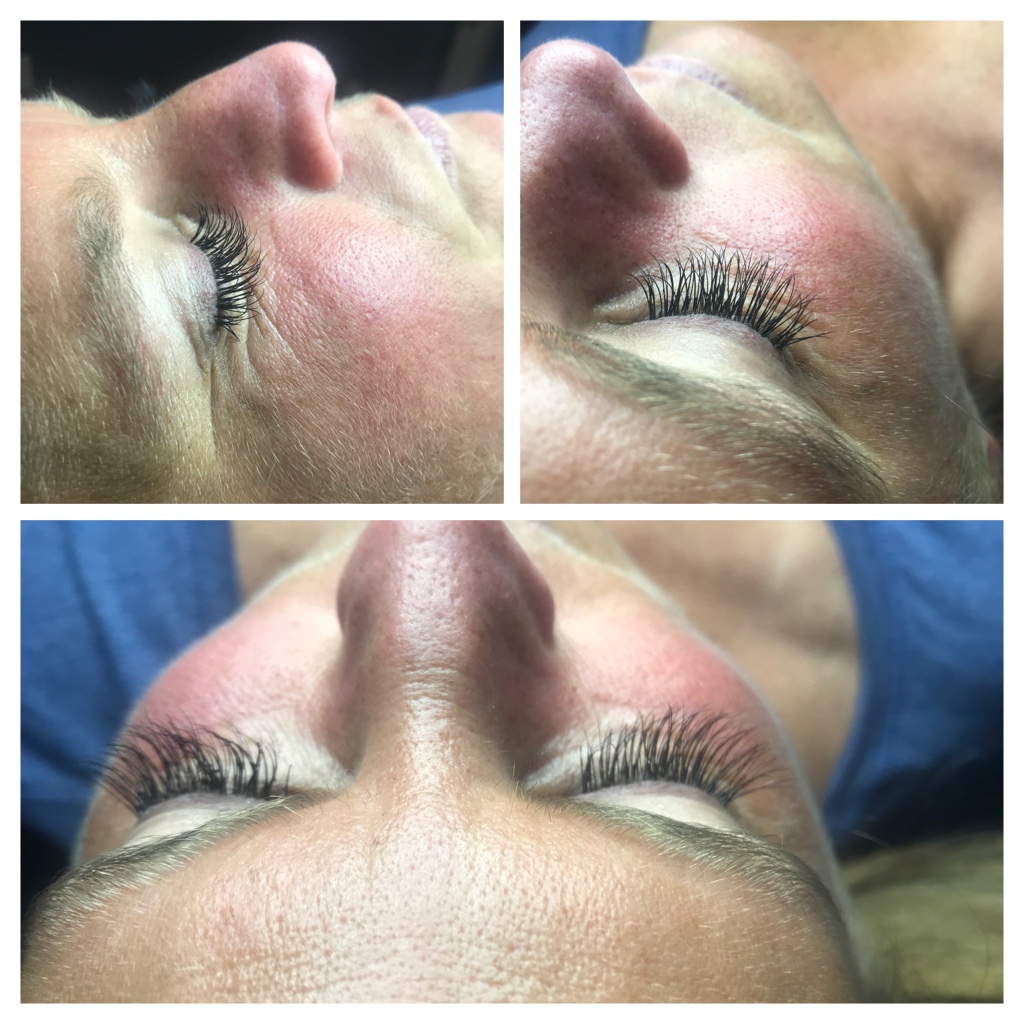 Bare Skin Beauty | 985 W Foothill Blvd # C, Claremont, CA 91711, USA | Phone: (909) 621-2218