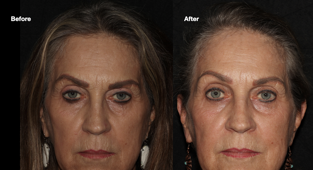 Leslie Pfeiffer, MD - Oculoplastic Surgeon | 11445 Dallas Pkwy, Frisco, TX 75034, USA | Phone: (214) 225-2577