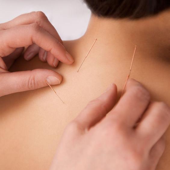 Hua-Bing Wen Acupuncture Center | 2506 Overland Ave, Los Angeles, CA 90064, United States | Phone: (310) 360-7556
