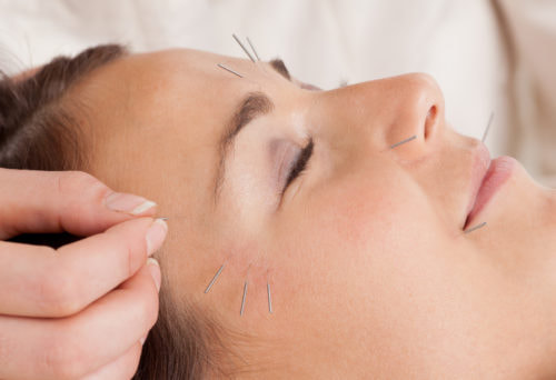 Shoreline Acupuncture | 2807 B Merrick Rd, Bellmore, NY 11710, United States | Phone: (516) 783-1454