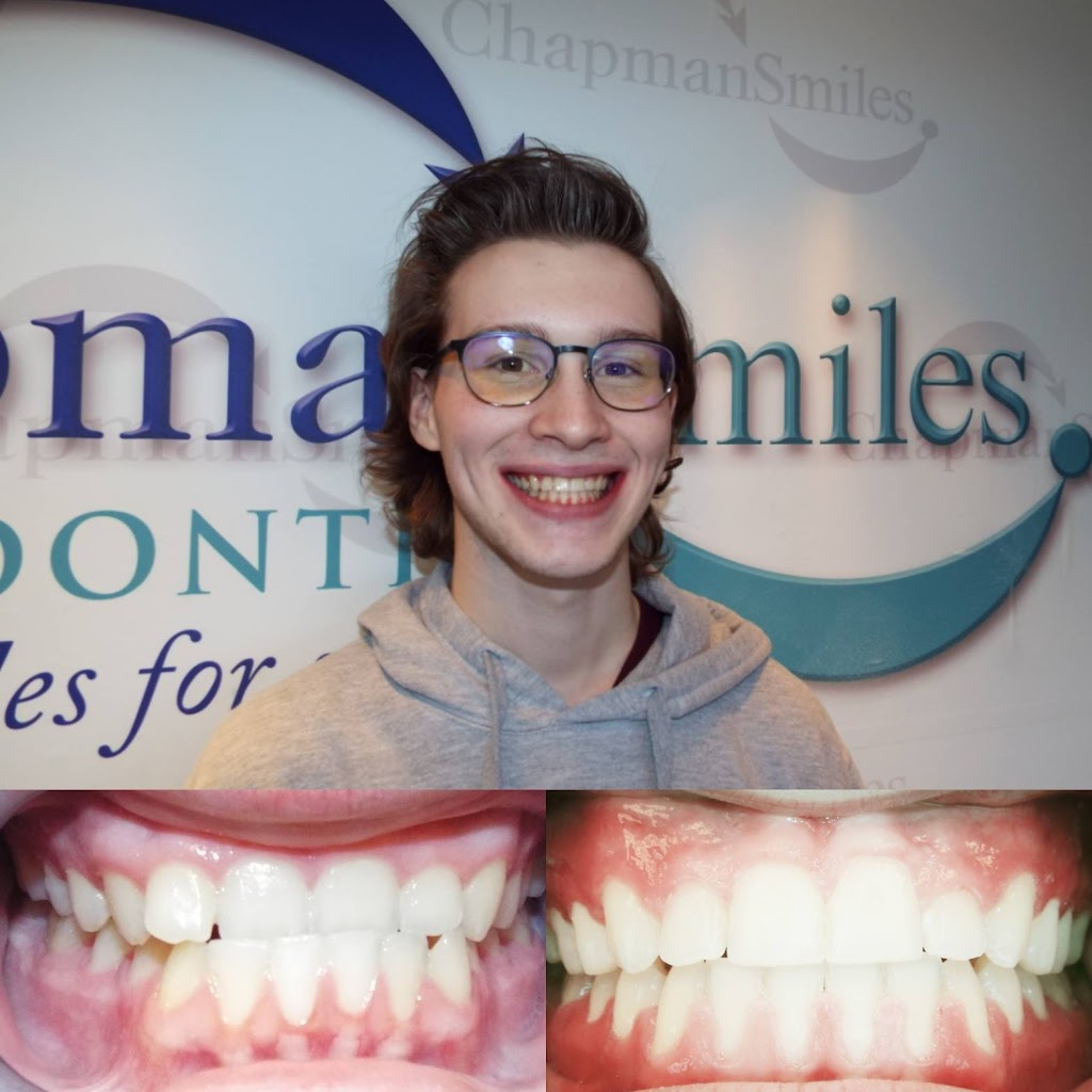 ChapmanSmiles Orthodontics: Gary E. Chapman, DDS | 14210 SE Sunnyside Rd Suite 300, Clackamas, OR 97015, USA | Phone: (503) 336-1883