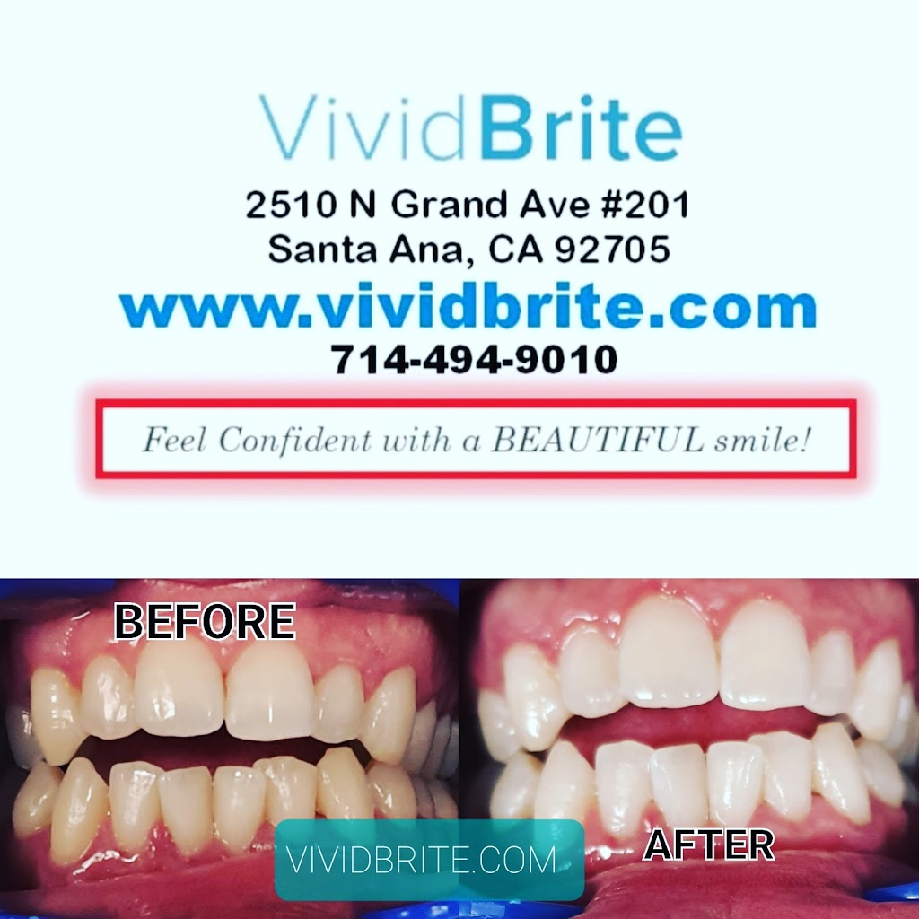 VividBrite Express Teeth Whitening starts $99 | 2510 N Grand Ave #201, Santa Ana, CA 92705, USA | Phone: (714) 494-9010