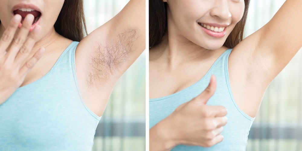 Roslyn Hair Removal & Electrolysis | 1137 Willis Ave, Albertson, NY 11507, USA | Phone: (516) 669-2892