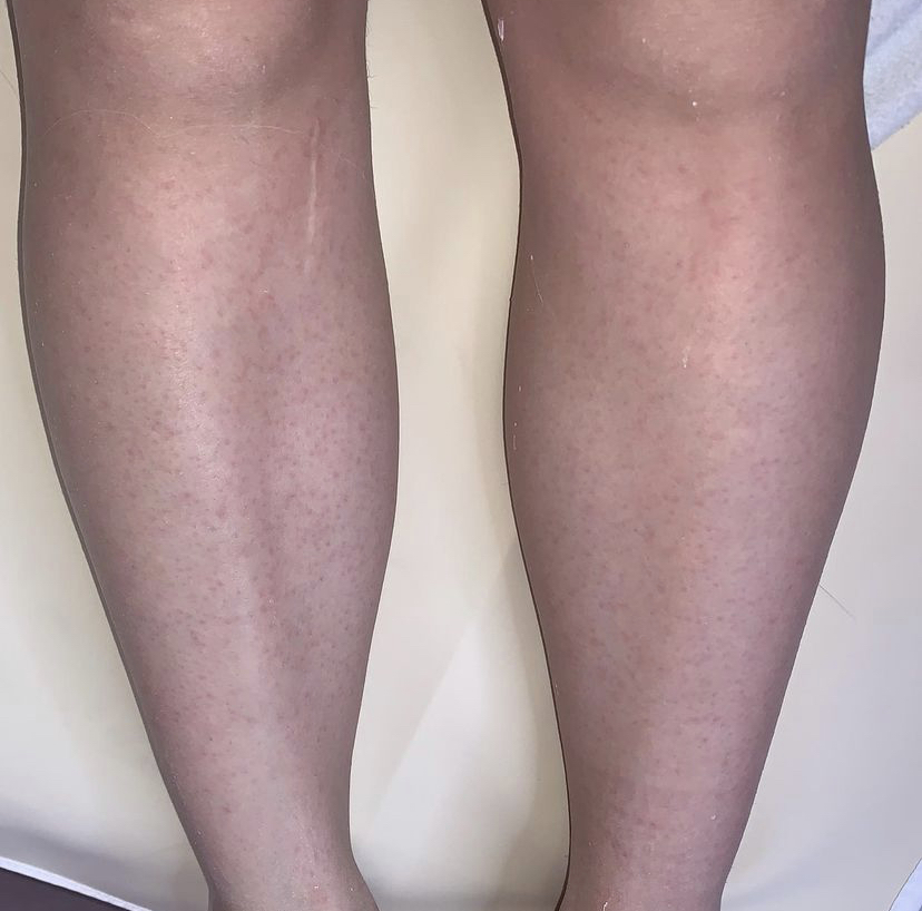 Dream Esthetics | 740 Texas St, Fairfield, CA 94534, USA | Phone: (707) 631-3583