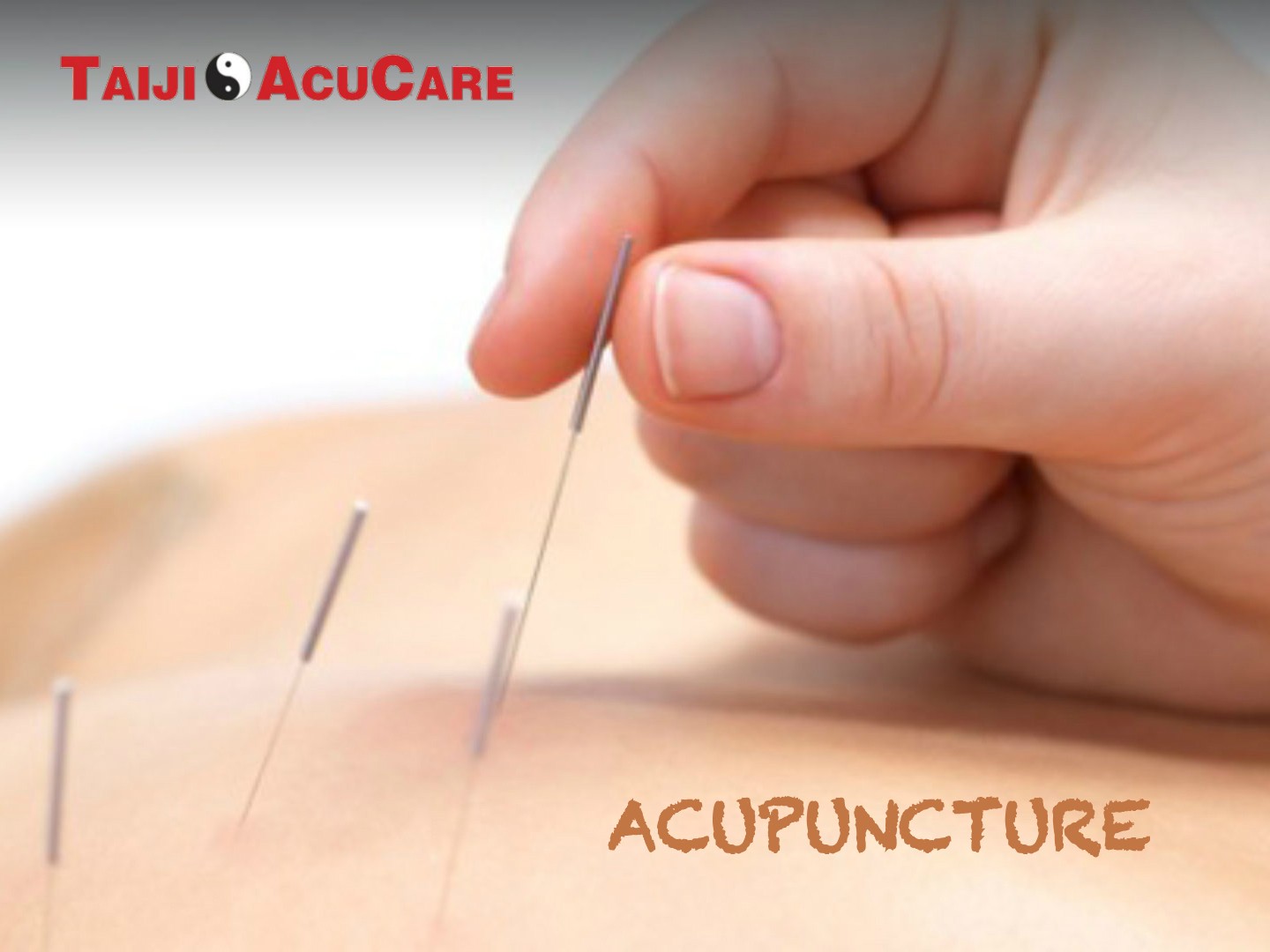 Taiji AcuCare | 1025 Pontiac Rd, Drexel Hill, PA 19026, United States | Phone: (484) 452-8188