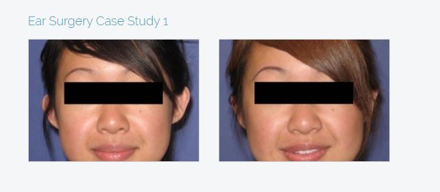 UCI Plastic Surgery | 200 S Manchester Ave #650, Orange, CA 92868, USA | Phone: (714) 456-3077