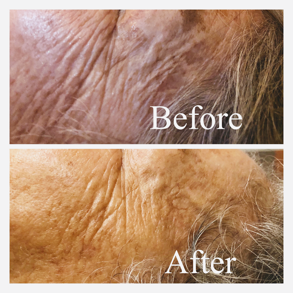 Afterglow Skin Therapy | Loft #18, 10800 Alpharetta Hwy Suite 240, Roswell, GA 30076, USA | Phone: (678) 749-1260